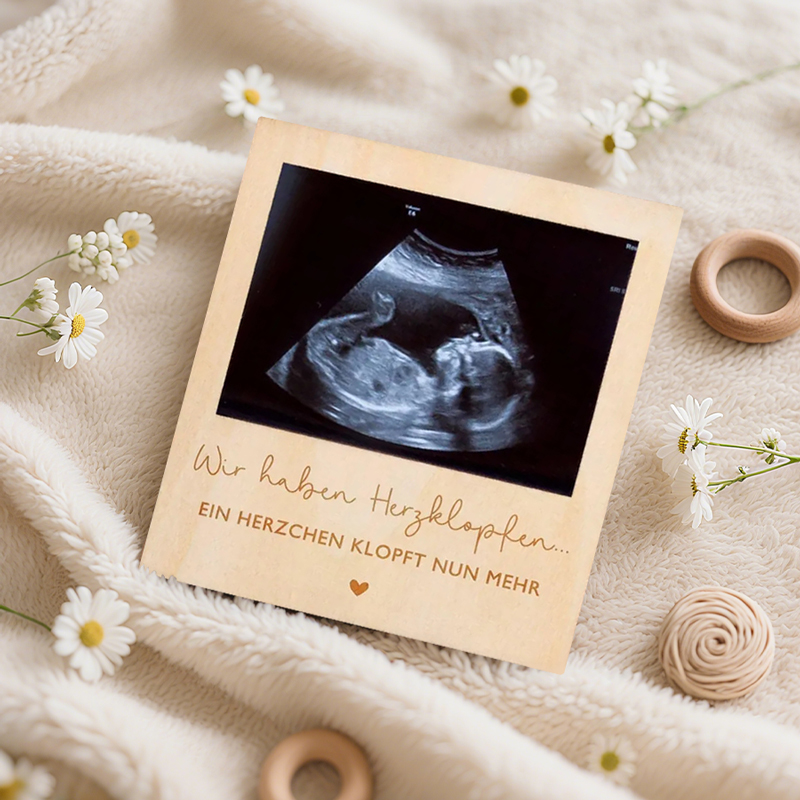Ультразвуковой знак объявления – обзор и цена Baby Nursery Images